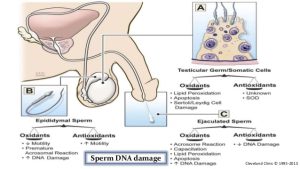 عفونت اسپرم