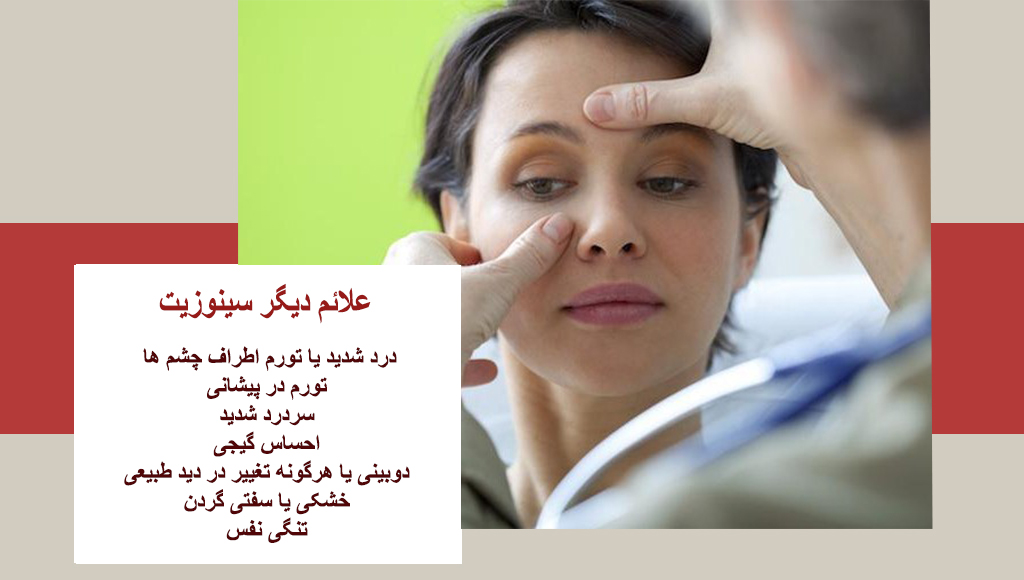 علائم سینوزیت سرگیجه