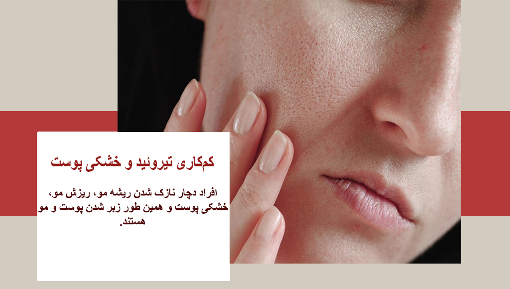 تیروئید و خشکی پوست