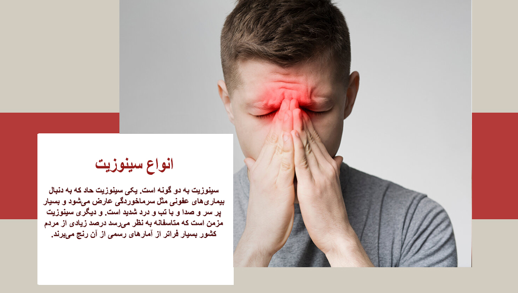 انواع سینوزیت