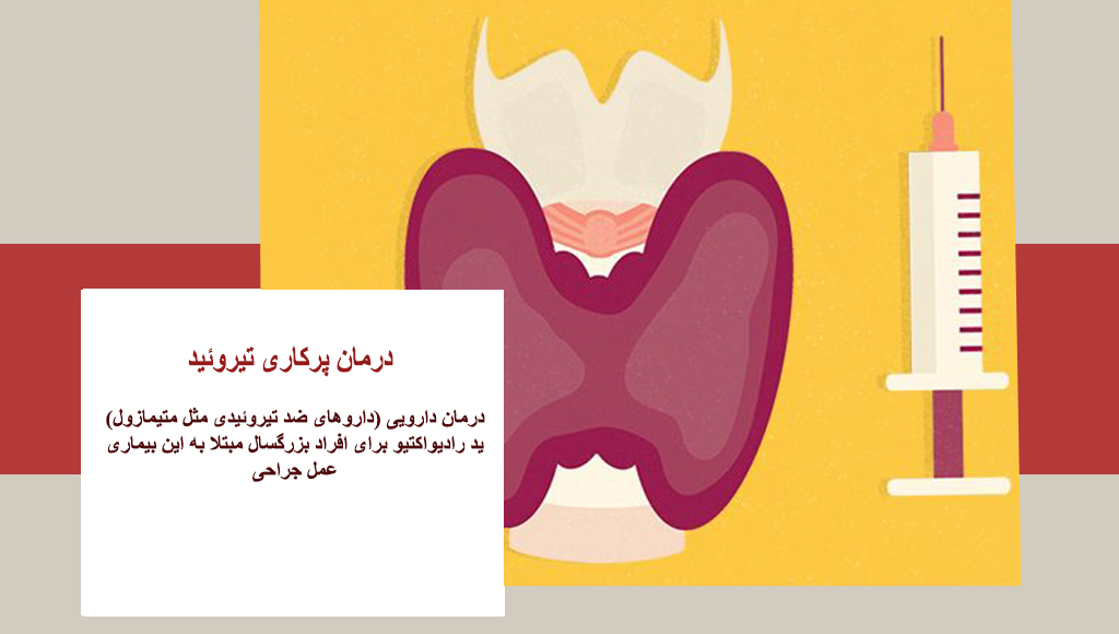 درمان تیروئید