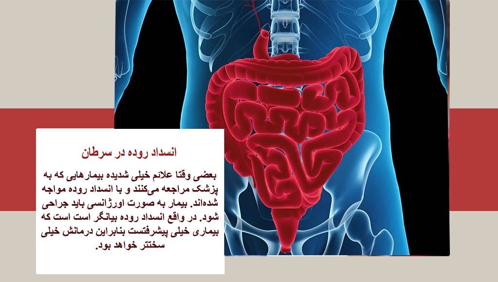 انسداد روده
