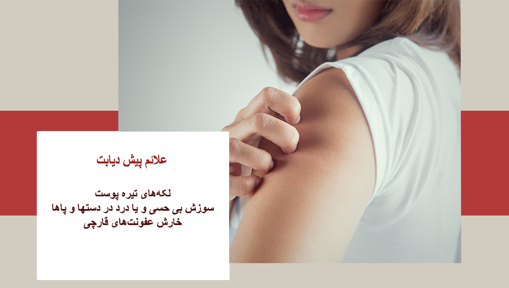 علائم پیش دیابت